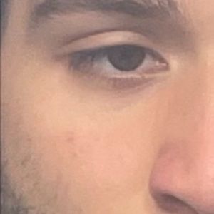 Meet your Posher, Robinson